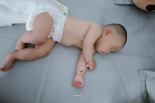 江西宝宝头上长痱子